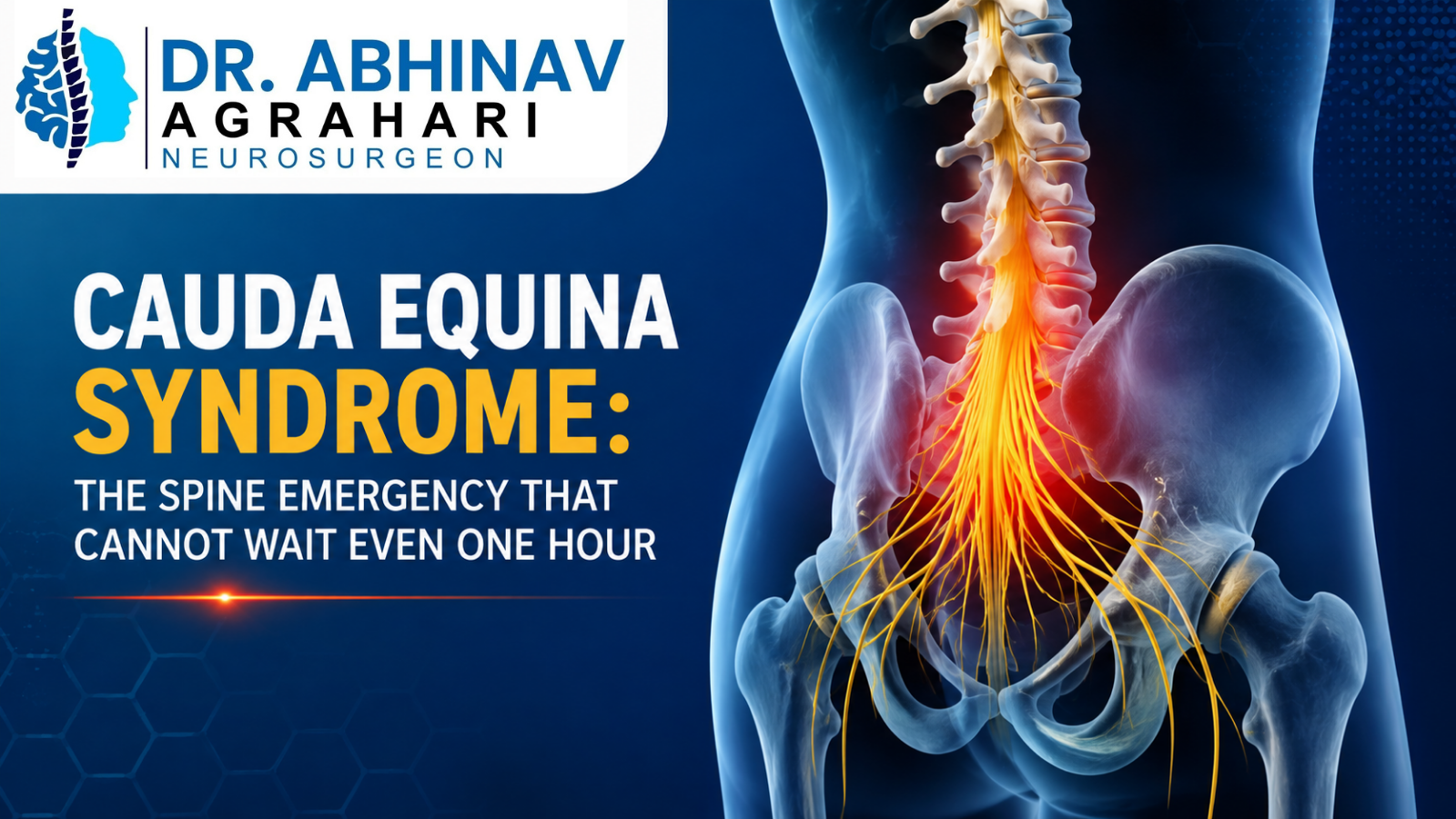 Cauda Equina Syndrome: The Spine Emergency That Cannot Wait Even One Hour